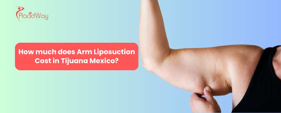 How Much Does Arm Liposuction Cost In Tijuana Mexico