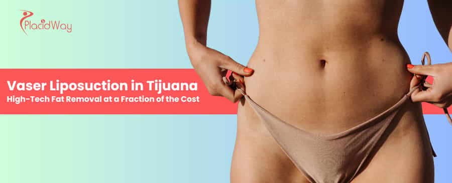 Vaser Liposuction In Tijuana