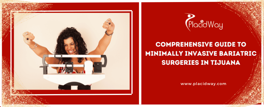 Guía completa de cirugías bariátricas mínimamente invasivas en Tijuana Comprehensive Guide to Minimally Invasive Bariatric Surgeries in Tijuana