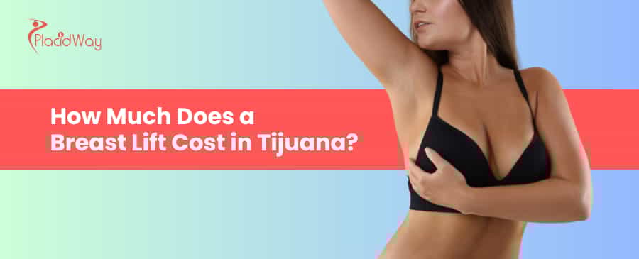 costo de levantamiento de senos en tijuana