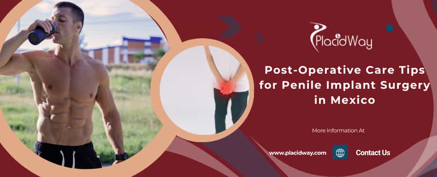 Post Operative Care Tips For Penile Implant Surgery In Mexico