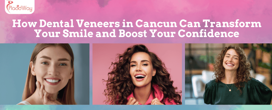 Cómo las carillas dentales en Cancún pueden transformar tu sonrisa y aumentar tu confianza