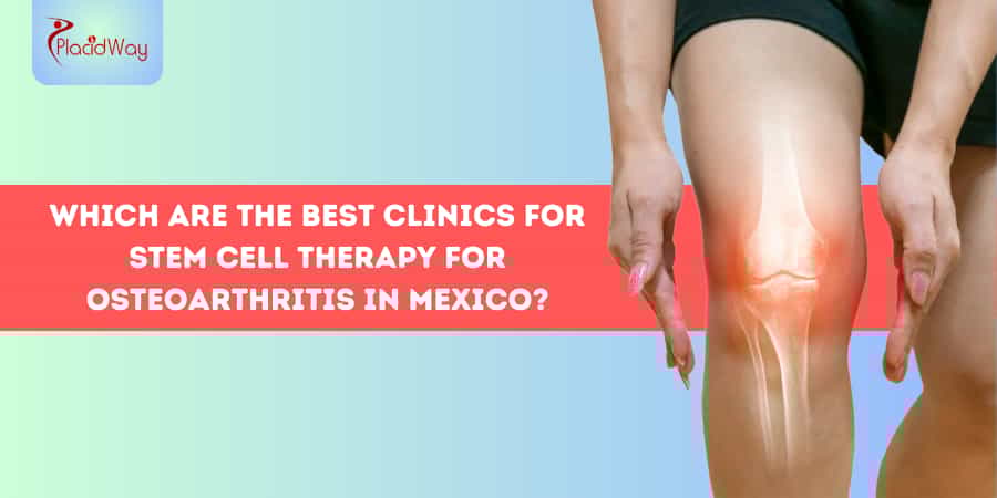 Terapia con células madre para la osteoartritis en México