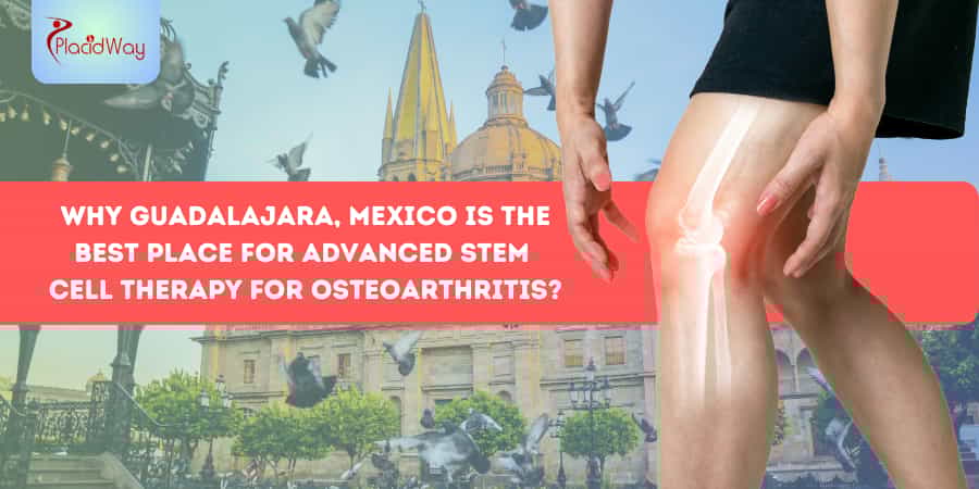 Terapia con células madre para la osteoartritis en Guadalajara
