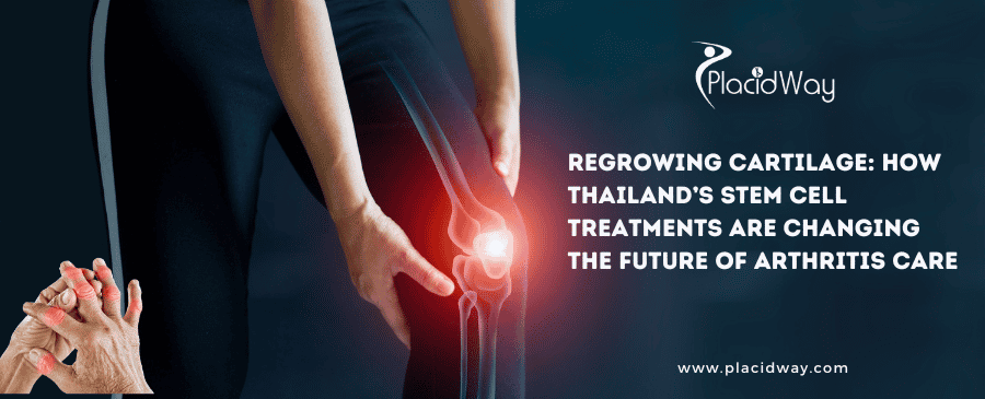 Stem Cell Treatments for Arthritis in Thailand