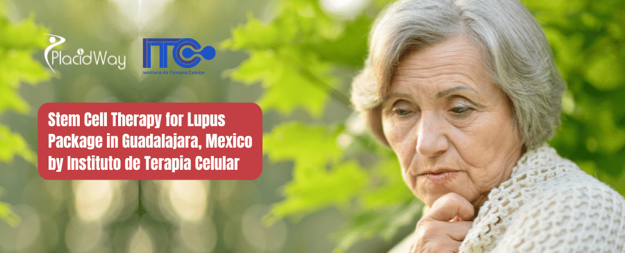 Paquete de Terapia con Células Madre para Lupus en Guadalajara, México por Instituto de Terapia Celular