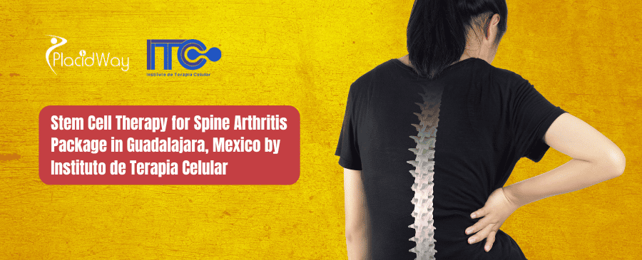 Stem Cell Therapy for Spine Arthritis Package in Guadalajara, Mexico by Instituto de Terapia Celular