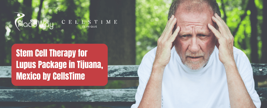Paquete de terapia con células madre para el lupus en Tijuana, México por CellsTime