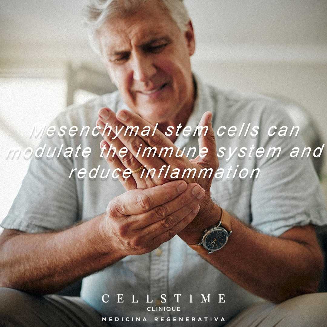 Paquete de Terapia con Células Madre para la Artritis Reumatoide en Tijuana, México