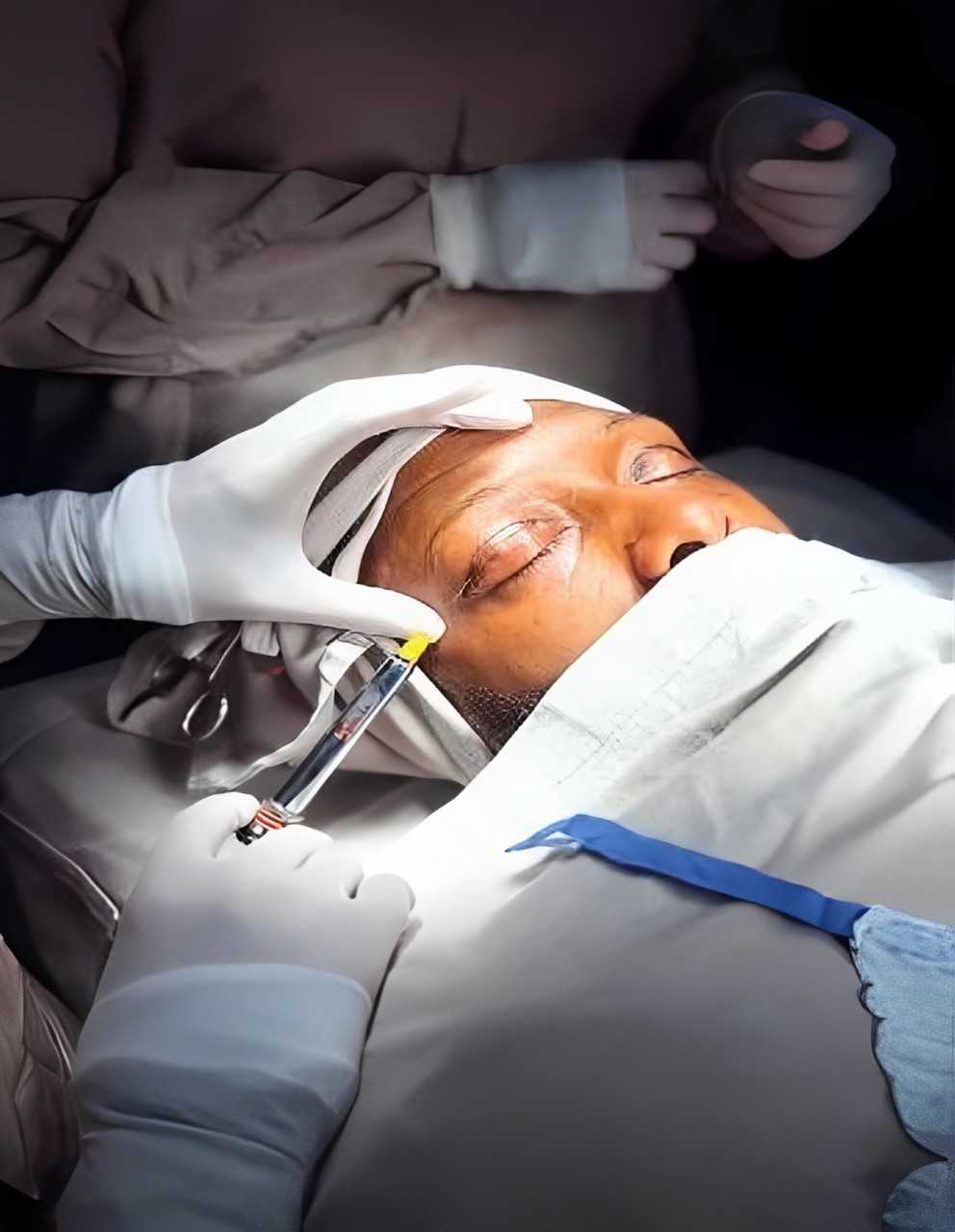 Cirugía de Párpados en Barranquilla Colombia