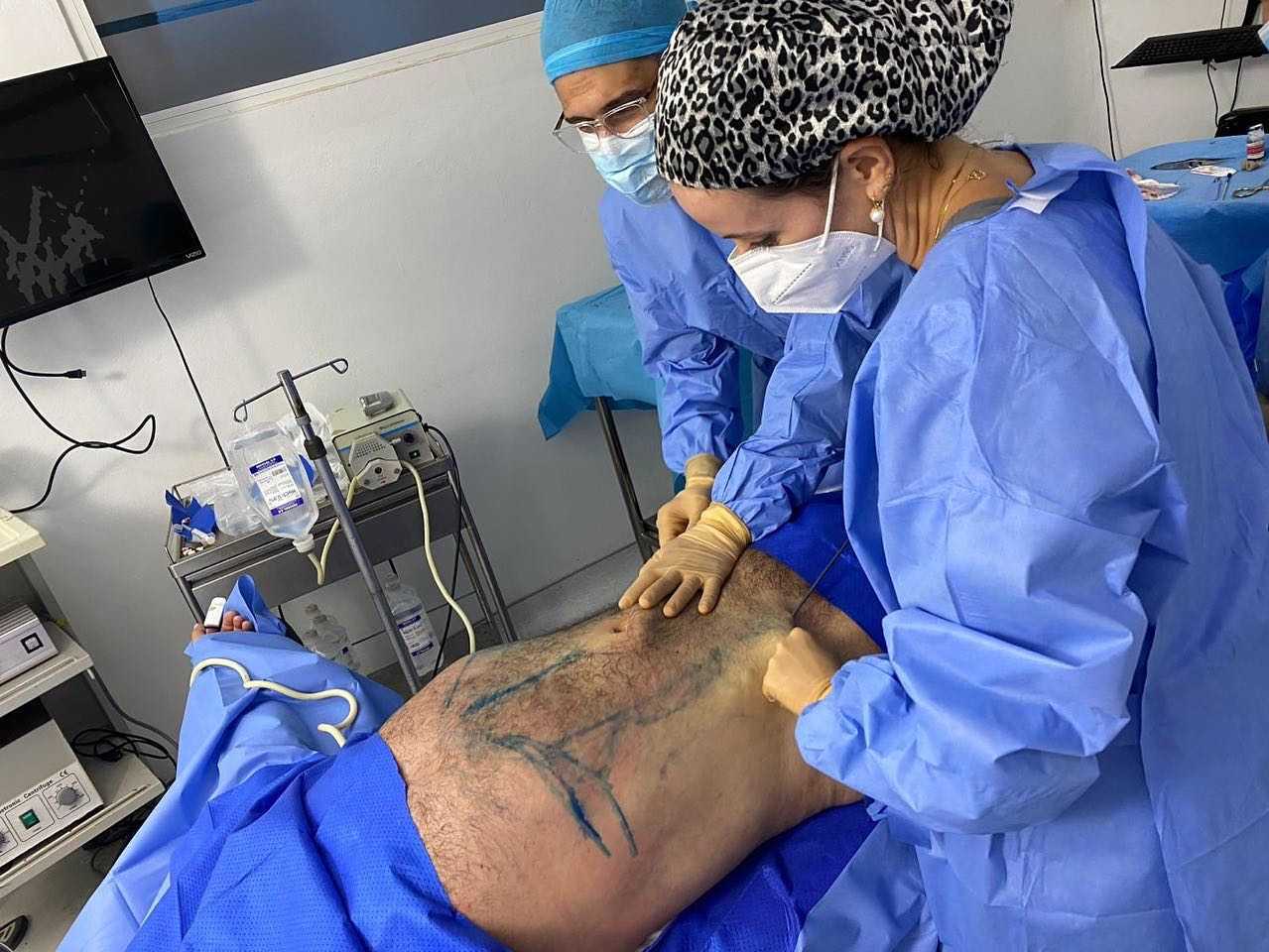 Abdominoplastia República Dominicana
