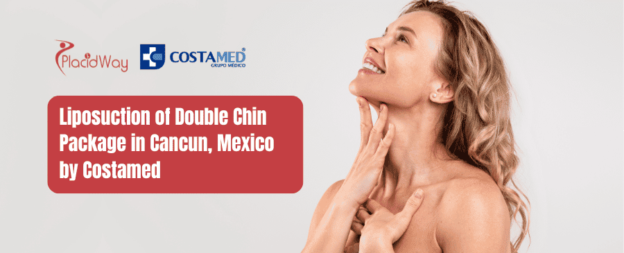 Liposuction of Double Chin Package in Cancun, Mexico by Costamed