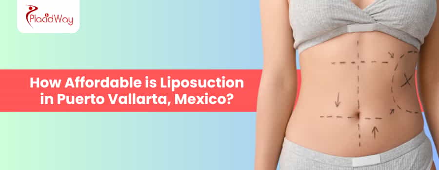 Liposuction In Puerto Vallarta