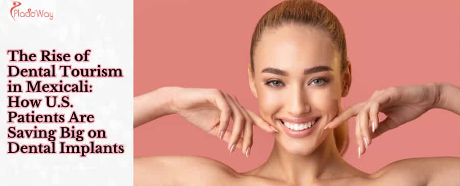 El auge del turismo dental en Mexicali Cómo los pacientes estadounidenses ahorran mucho dinero con los implantes dentales