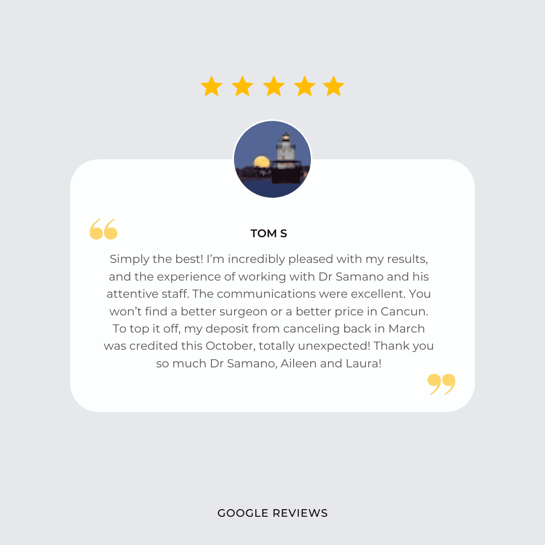 Reseña de Google Google Review