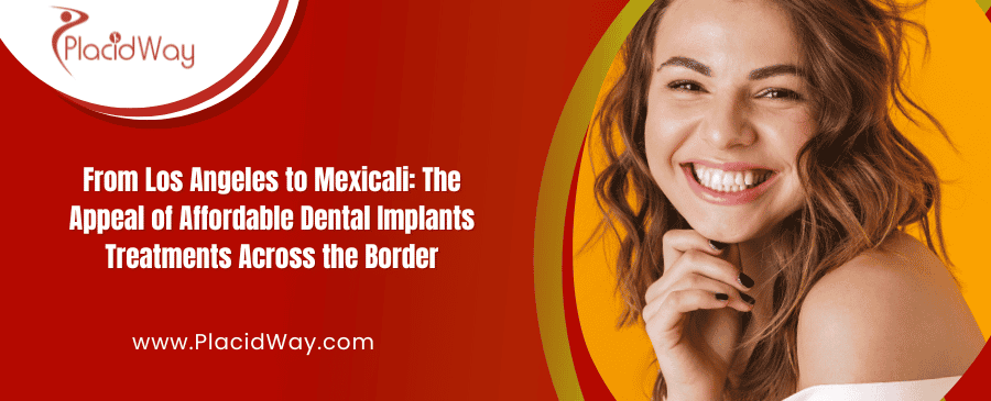 Implantes dentales asequibles en Mexicali