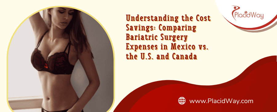 Cirugía bariátrica en México vs. Estados Unidos y Canadá