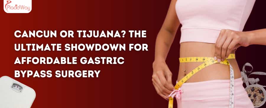 Cancun or Tijuana The Ultimate Showdown for Affordable Gastric Bypass Surgery