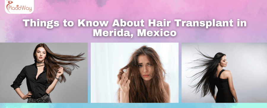Hair Transplant in Merida Mexico Things to Know About Hair Transplant in Merida, Mexico