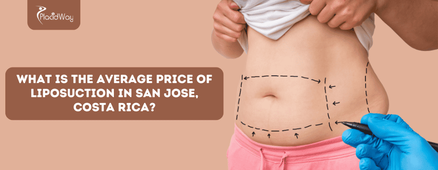 What Is The Average Price Of Liposuction In San Jose, Costa Rica