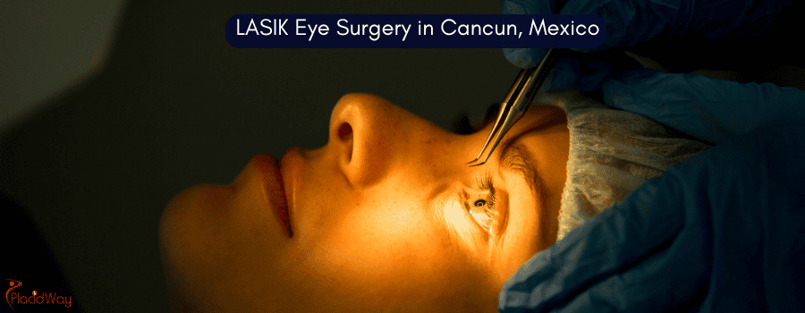 LASIK Eye Surgery in Cancun, Mexico
