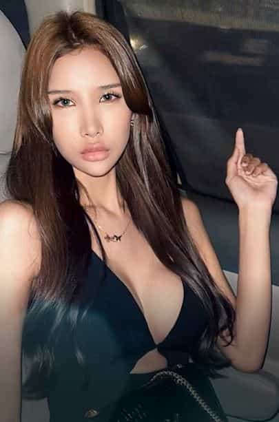 V-образная челюстная хирургия в Бангкоке, Таиланд - история пациента