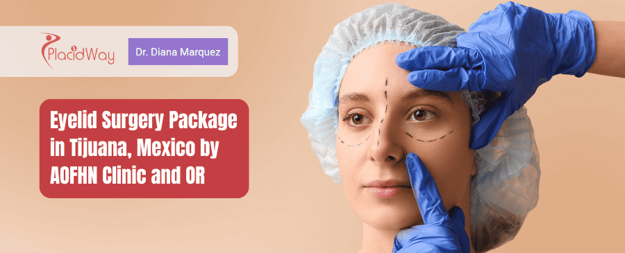Paquete de cirugía de párpados en Tijuana, México por Clínica y quirófano AOFHN