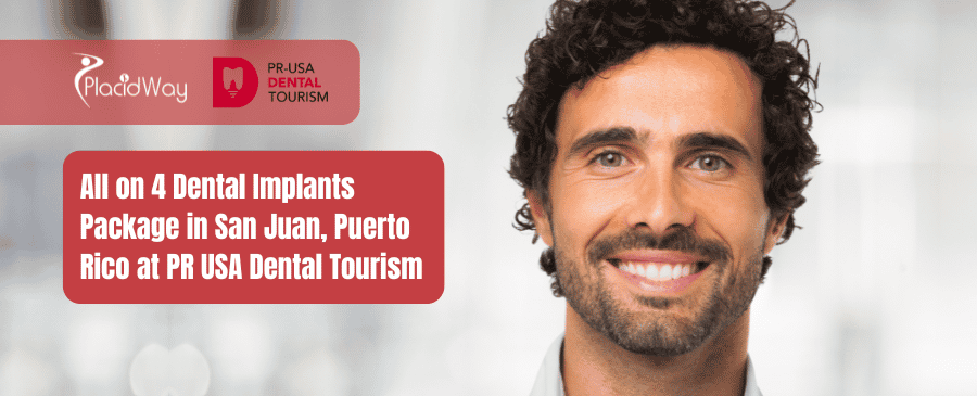 Paquete de implantes dentales All on 4 en San Juan, Puerto Rico en PR USA Dental Tourism