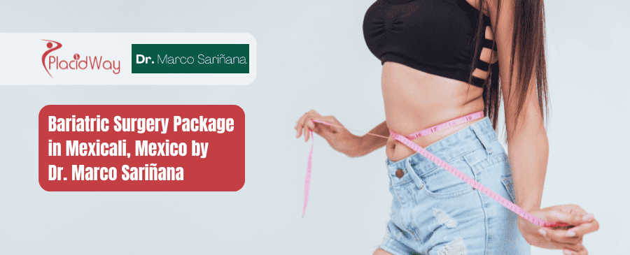 Paquete de Cirugía Bariátrica en Mexicali, México por el Dr. Marco Sariñana