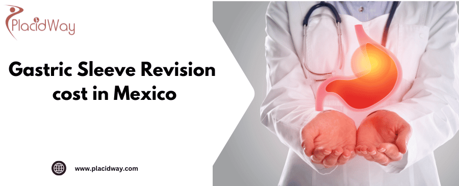 Gastric Sleeve Review Cost in Mexico