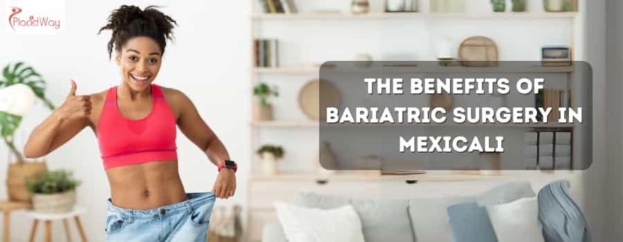 Los beneficios de la cirugía bariátrica en Mexicali