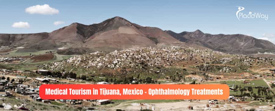 Turismo Médico en Tijuana, México – Tratamientos Oftalmológicos