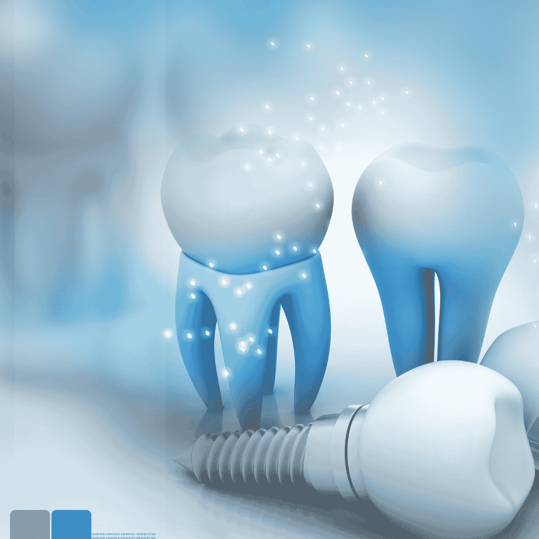 Zirconia Dental Implants