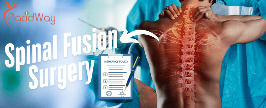 Costo de la cirugía de fusión espinal sin seguro