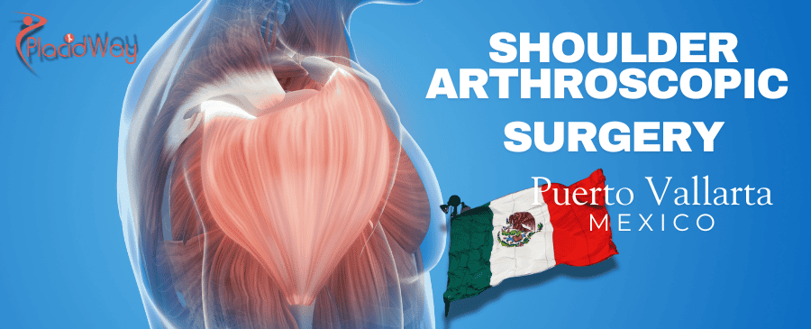 Average Cost of Shoulder Arthroscopic Surgery in Puerto Vallarta, Mexico