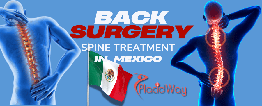 Back Surgery In Mexico
