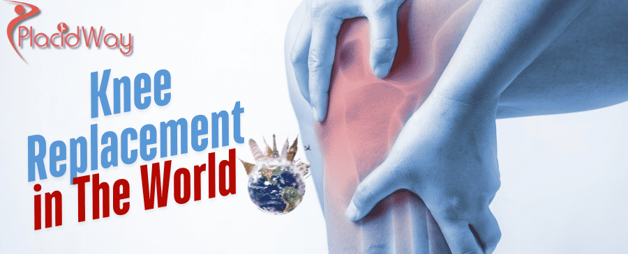 El mejor lugar del mundo para obtener un reemplazo de rodilla