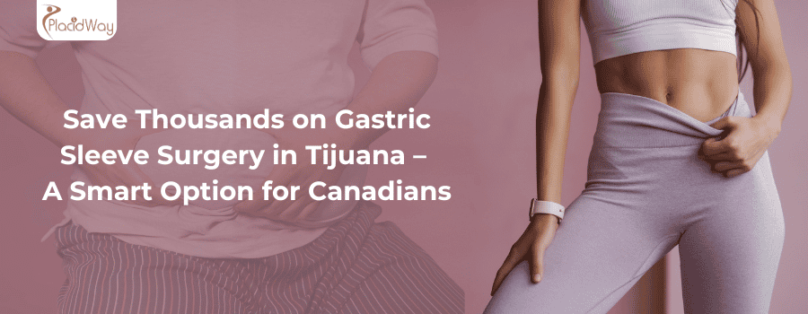 Ahorre miles en la cirugía de manga gástrica en Tijuana: una opción inteligente para los canadienses.