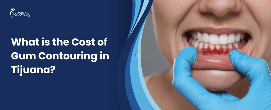 Cost of Gum Contouring in Tijuana