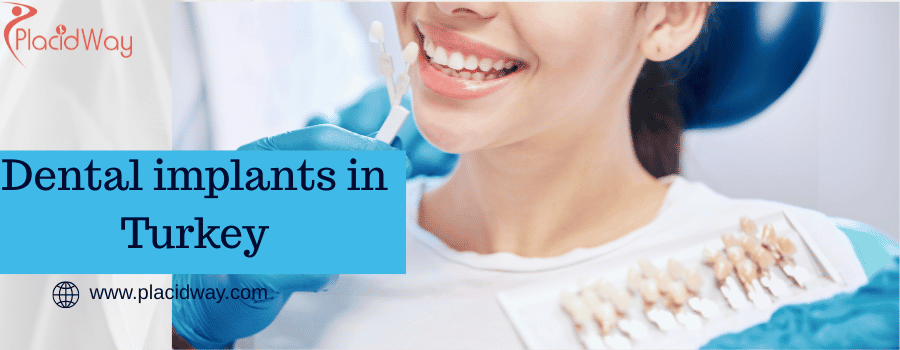 Dental implants in Turkey