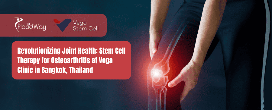 Eine Grafik zur Veranschaulichung der Stammzellentherapie bei Kniearthrose mit Schwerpunkt auf Bangkok, Thailand.
