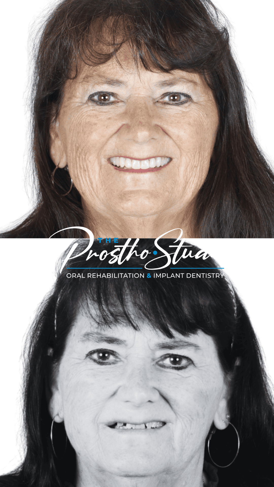 Reseña de Prostho Studio