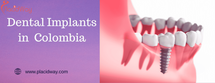 Dental Implants in  Colombia