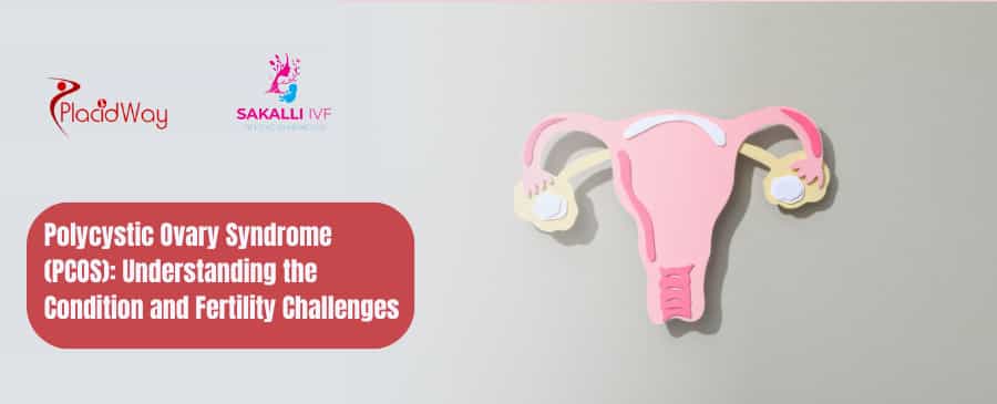 Polycystic Ovary Syndrome (PCOS) Understanding the Condition and Fertility Challenges