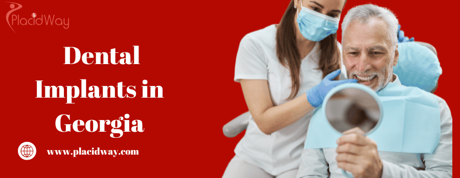 Dental Implants in Georgia