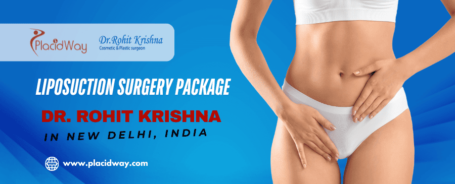 Липосакция Нью-Дели