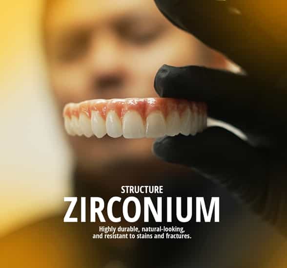 Implantes Dentales All-on-Four en Los Algodones México