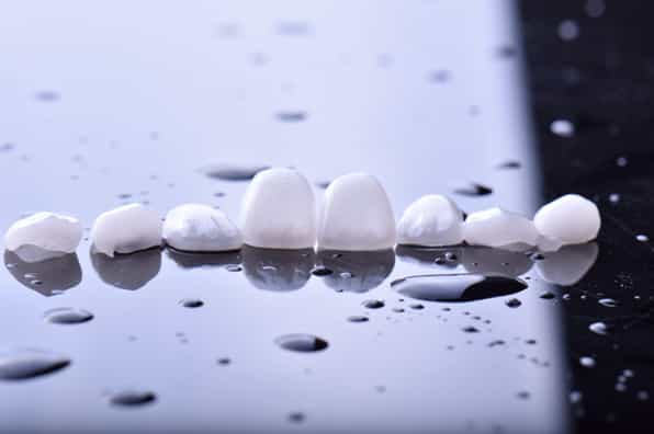 Costo de Carillas Dentales en Los Algodones