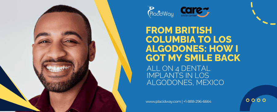 All on 4 Dental Implants in Los Algodones | Saved 65%