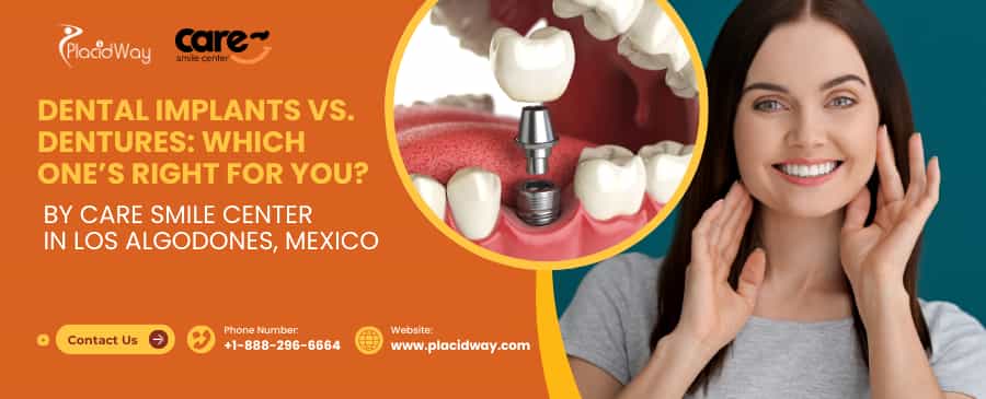 Dentures Los Algodones Mexico or Implants? | Your Guide